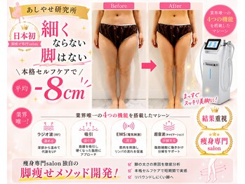 メディカルエステ 大宮店/※痩身症例写真※ 痩身/痩身