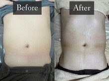 ベルフィーヌ 恵比寿店(BELFINE)/男性のぽっこりお腹もスッキリ