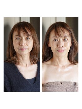 サロン ド オージャス(salon de ojas)/光フェイシャル