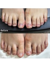 リリ(lili)/フットケア/ネイルスキンケア