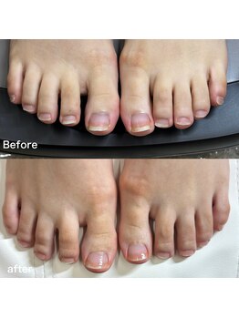 リリ(lili)/フットケア/ネイルスキンケア