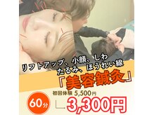 サンテ