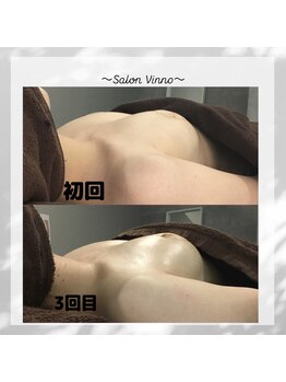ヴィノ アイサロン(VINNO eyesalon)/お客様ビフォーアフター