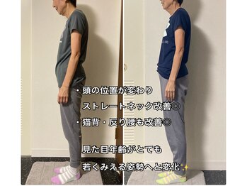 ナナ 吉祥寺店(NANA)/BeforeAfter