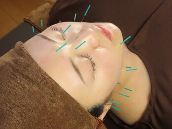 ふく 江別店/＝美容鍼コース＝