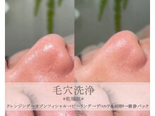 イリジアエリート(inizia elite)