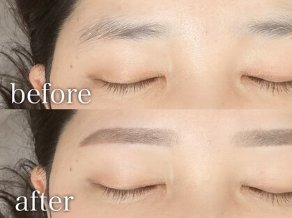 フランク(Frank)の写真