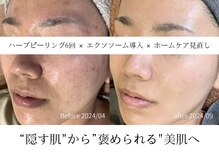 サロンメロウ 大牟田店(salon mellow)