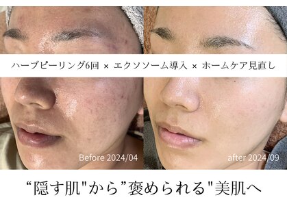 サロンメロウ 大牟田店(salon mellow)の写真