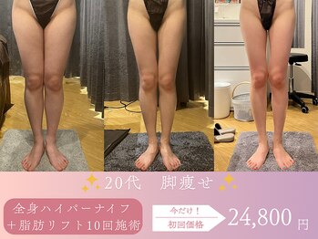 スリムプロ/下半身引き締め