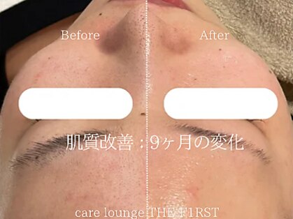 ケア ラウンジ ザ ファースト(THE F1RST)の写真