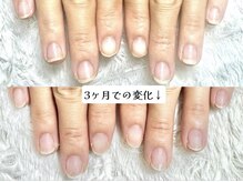 グラシナ 名古屋金山店/(深爪／長さだし/フィルイン)