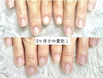 グラシナ 名古屋金山店/(深爪／長さだし/フィルイン)