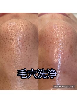 アトリエ ハルミナ(atelier harumina)/毛穴ケア・毛穴洗浄 三島エステ