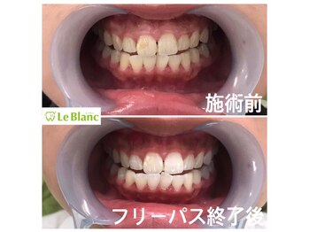 ルブラン 奈良店(Le Blanc)/化粧では隠せない、ごまかせない