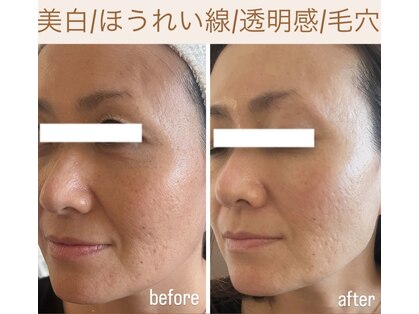 フルー(FLEUR)の写真