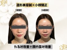 エモシオン トウキョウ(EMOTION TOKYO)/造形フェイス