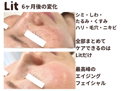 ワッカ(wacca)の写真