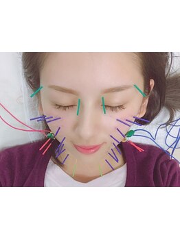 鍼灸施術を受けたい