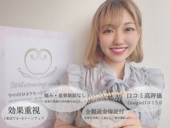 ダイヤモンドビューティー(DIAMOND BEAUTY)/ホワイトニングといえば当店