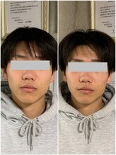 ペリー(PELLY)/美容液を導入