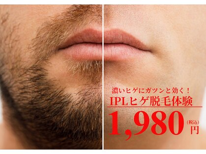 メンズ エステティック ヒーロー(men's esthetic HERO)の写真