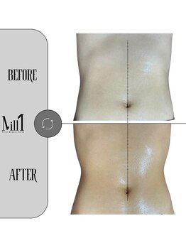 ミル 恵比寿店(Mill)/《痩身》