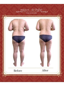 メゾン ド サファリ(maison de Safari)/50代/初回80分/ビフォーアフター