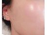 【紫外線ダメージを受けた肌に】100％天然ハーブでつるん肌へ◎