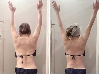 ユヴィラ(YUVIRA)の写真/【ガチガチ背中・首・肩をゆるめる】ツライ首・肩・背中の深部にしっかりアプローチ！極上ヘッドスパ付◎