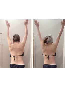 首・肩のつらさを改善したい