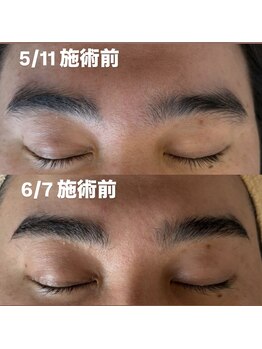 ブリリア(Brillia)/アイブロウ脱毛で整う清潔感