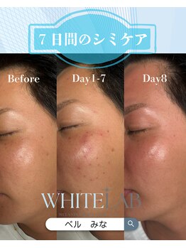 ベル(BELLE)/ホワイトラボ