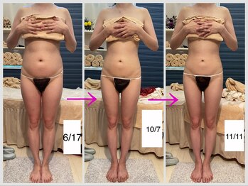 ヴィオラ(Viola)/痩身のお客様