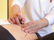 おさかべ鍼灸院/鍼灸