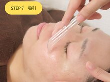 エステティックジュビラン エタンセル(Etincelle)/吸引