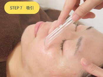 エステティックジュビラン エタンセル(Etincelle)/吸引