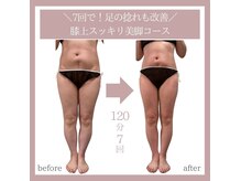 アイナ(aina)の雰囲気（痩せにくい下半身もお任せください！無料相談実施中）