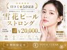口コミ★5.0記念｜雪花ピールストロング ￥20,000　白玉肌を目指すならこれ！