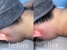 マドンナリリー 恵比寿店(Madonna Lily)/お客様before/after