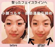 小顔骨気専門サロン パトラ(PATORA)