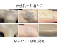 ミーラブ 鹿児島(miilove)