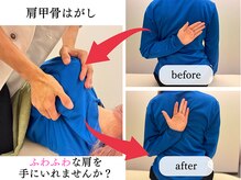 横浜駅きた西整体院/肩こり/巻き肩/反り腰