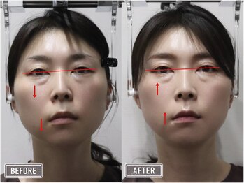 さつま骨格矯正 表参道青山院/歪み小顔矯正＋骨盤矯正