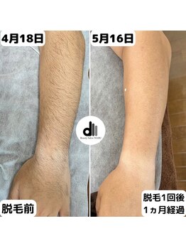 ビューティーサロン マル(Beauty Salon MARU)/