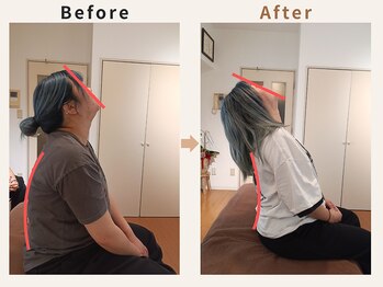 ハリデイズ/30代-肩首こり、頭痛