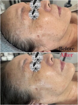 マシェリ(ma-che'rie)/バクチ甦生プログラム