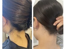 ミース 福岡本店/うなじ矯正◆ビフォーアフター