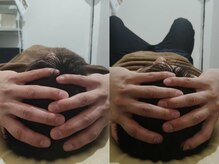 吉川美南ライフ整骨院/30代男性