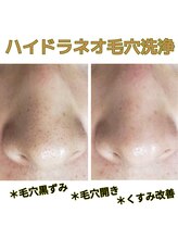 ココロ(COCORO)/大人気♪毛穴の大掃除